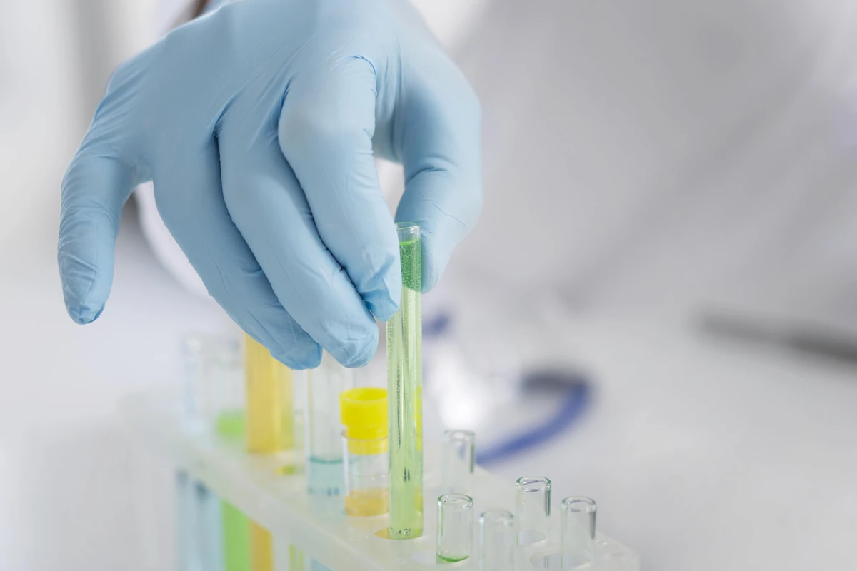 Védőkesztyűs kéz laboratóriumi mintát tart